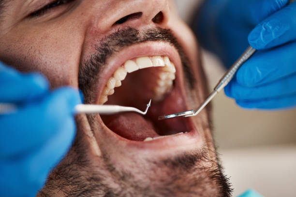 Emergency Dental Services in Endicott, NY